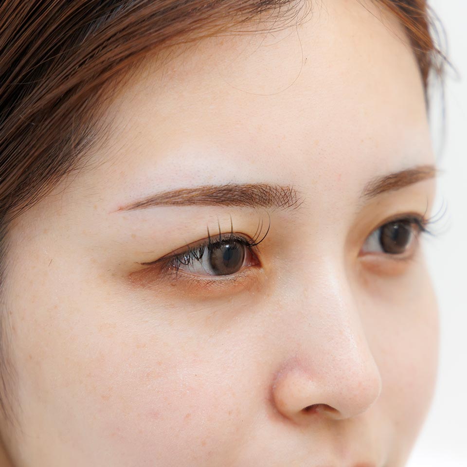 アートメイク - KMT MEDICAL CLINIC