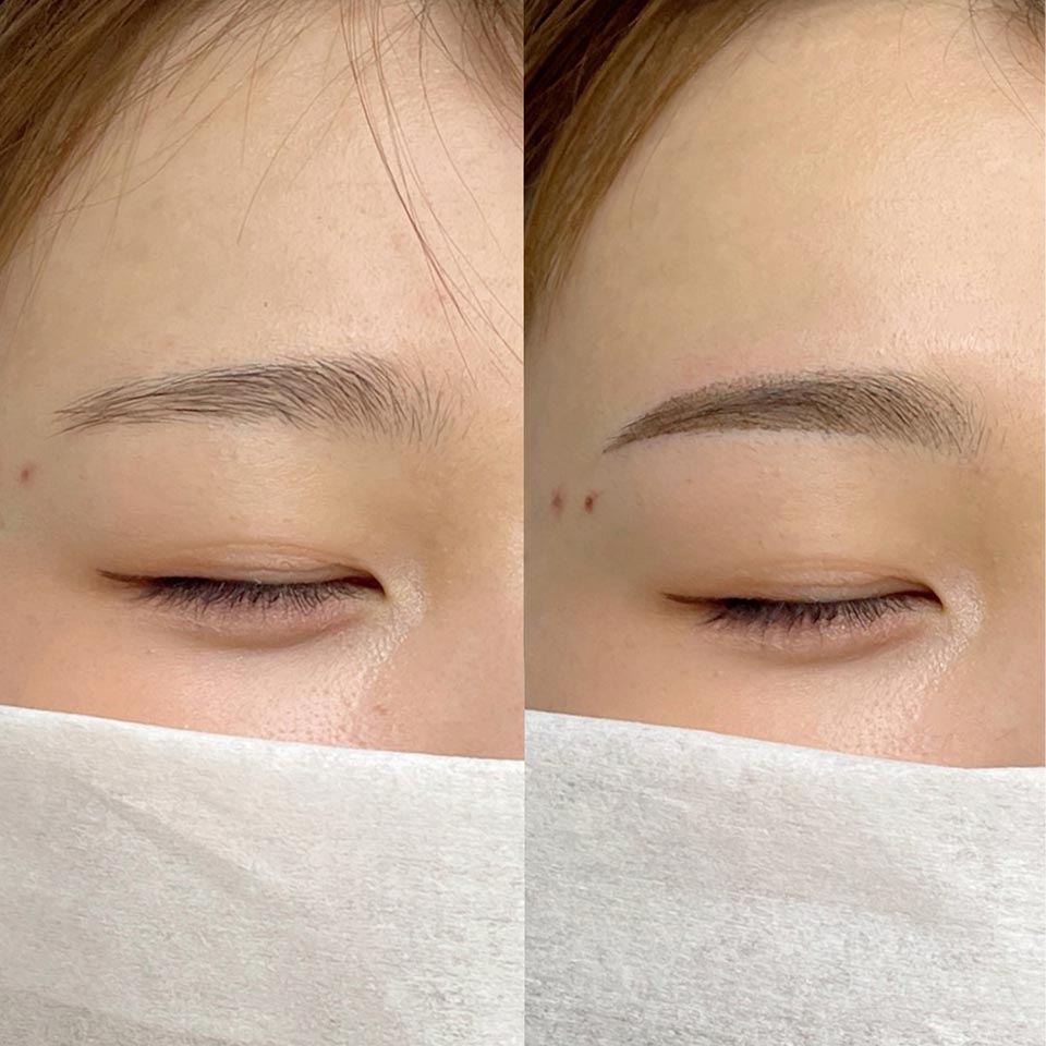 アートメイク - KMT MEDICAL CLINIC