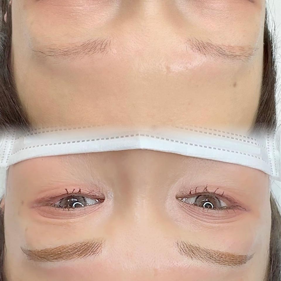 アートメイク - KMT MEDICAL CLINIC