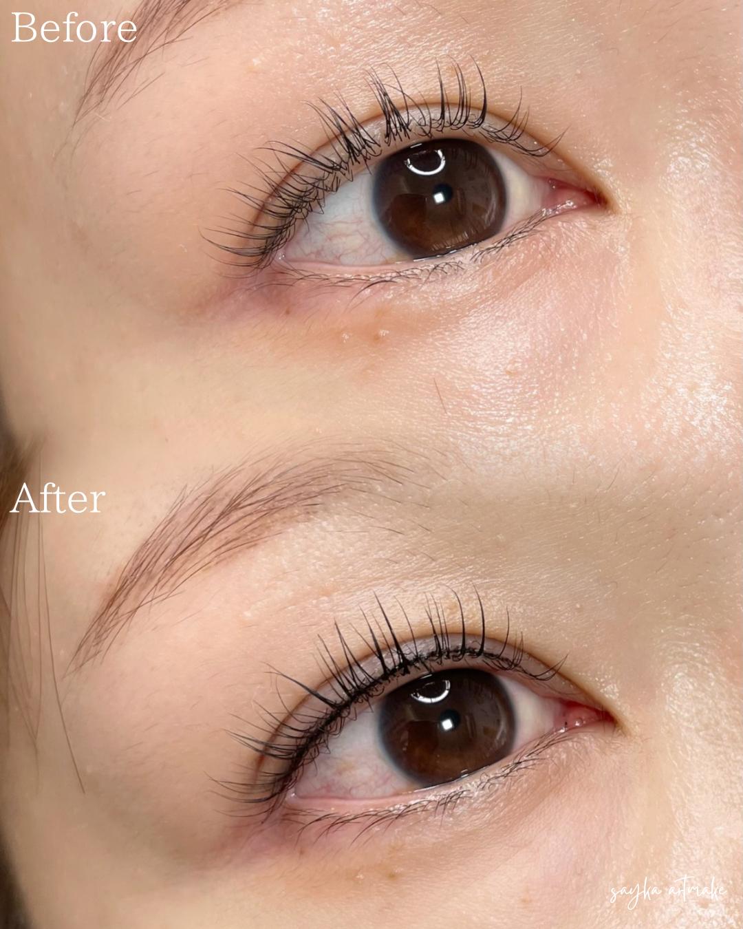 アートメイク - KMT MEDICAL CLINIC