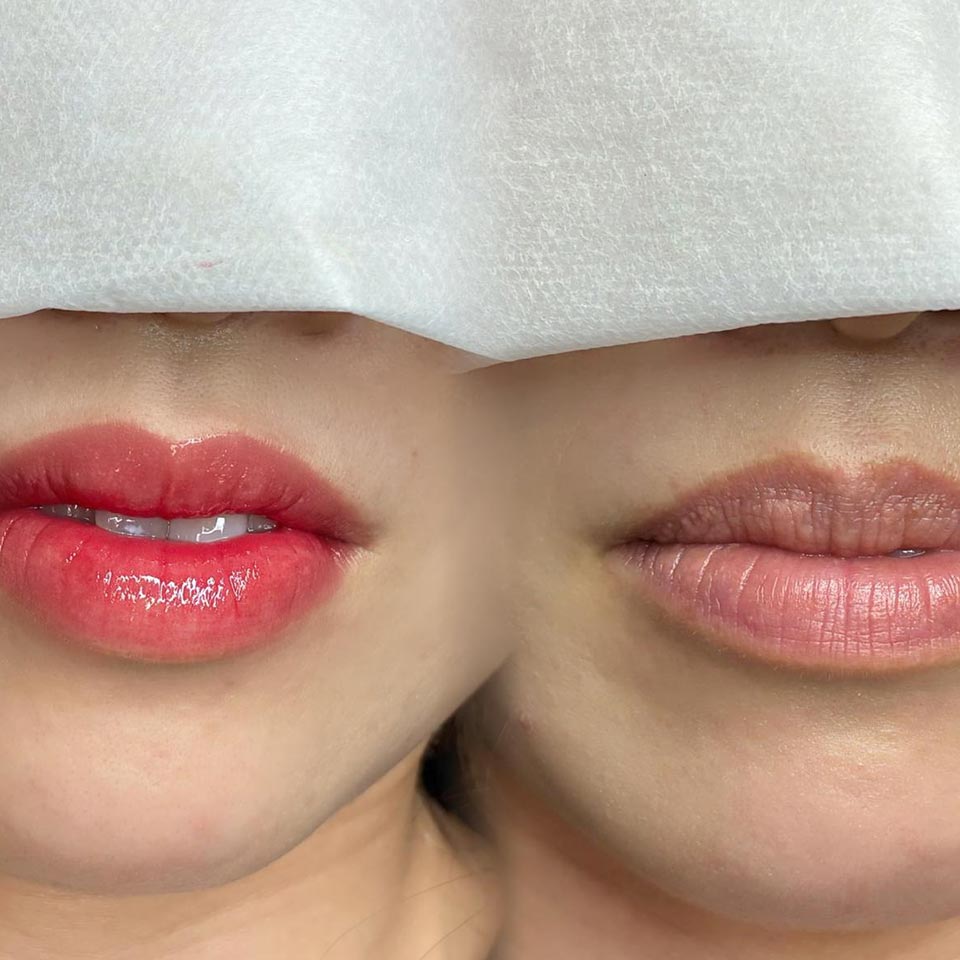 アートメイク - KMT MEDICAL CLINIC