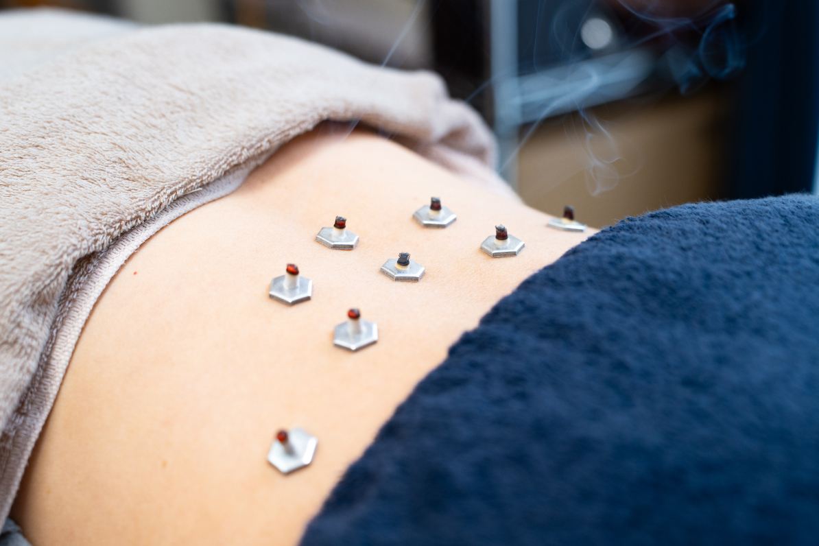 鍼灸整体 - 株式会社Give Birth