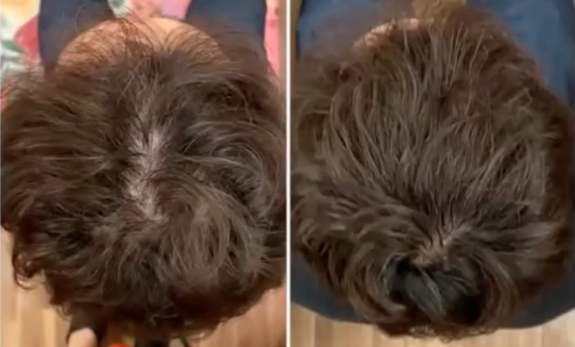 フェムケア矯正® - Private Salon HICO